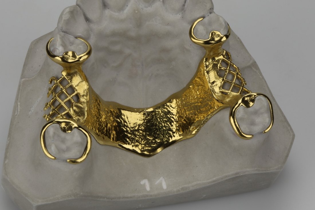 Vergolden, Dental-Studio Bern